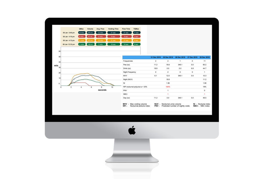 iUFlow Report on Mac + iPhone. Urine flow charts and Bladder diary side-by-side